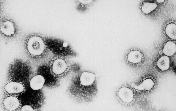 Что ученые узнали о коронавирусе к этому времениСюжет - «Наука»