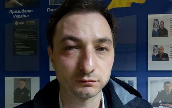 Главврача Нацинститута рака избили в Киеве - «Украина»