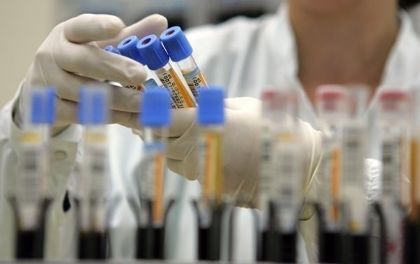 В Нидерландах ученые нашли антитело к коронавирусу - «В мире»