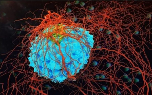 Найдена новая возможность для лечения рака - «Наука»