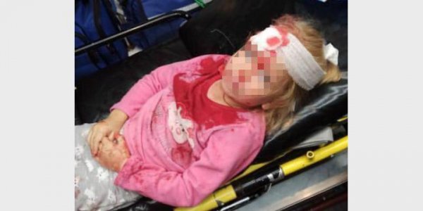 Белорусский ОМОН напал на семью с маленьким ребенком. Пятилетняя девочка попала в больницу - «Политика»